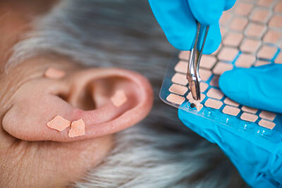 Indicaciones para un tratamiento de auriculoterapia